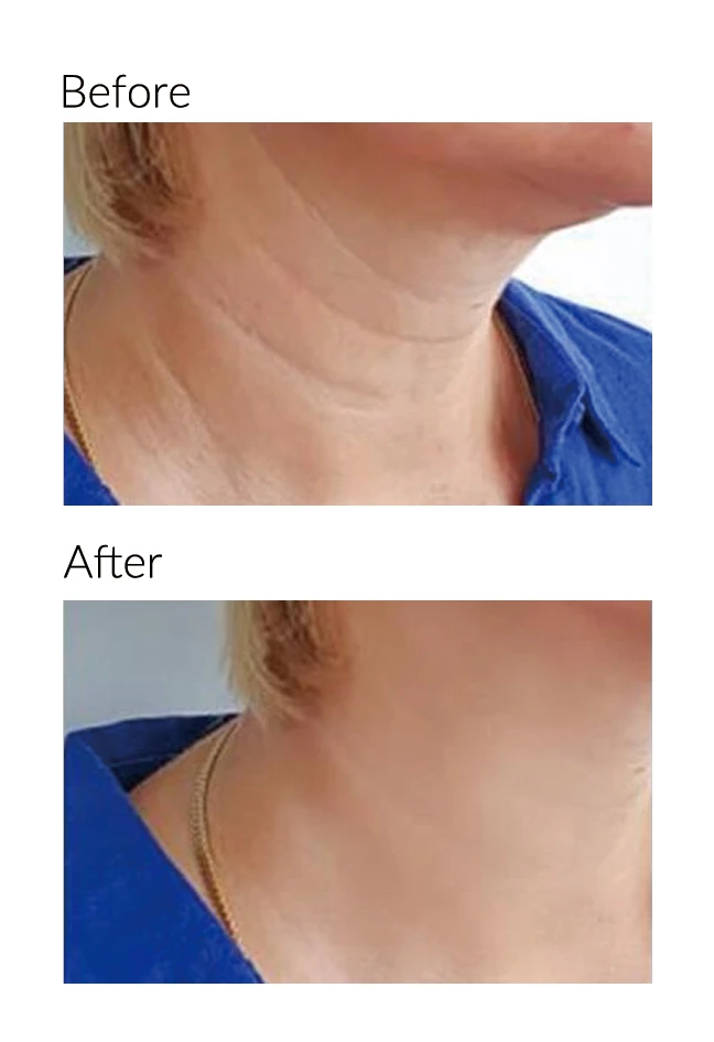 neck