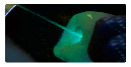 Root Canal Disinfection