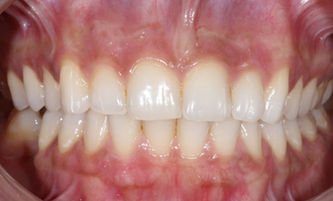 A normal pink color after 2 weeks