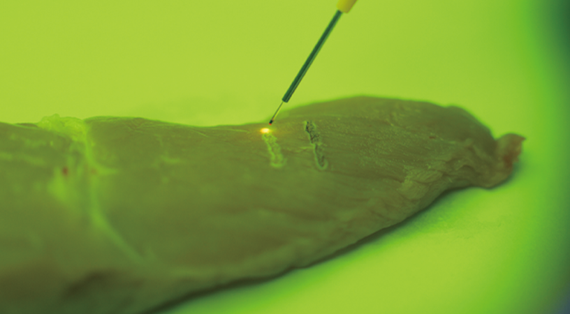 traditional laser mode and Super Pulse mode