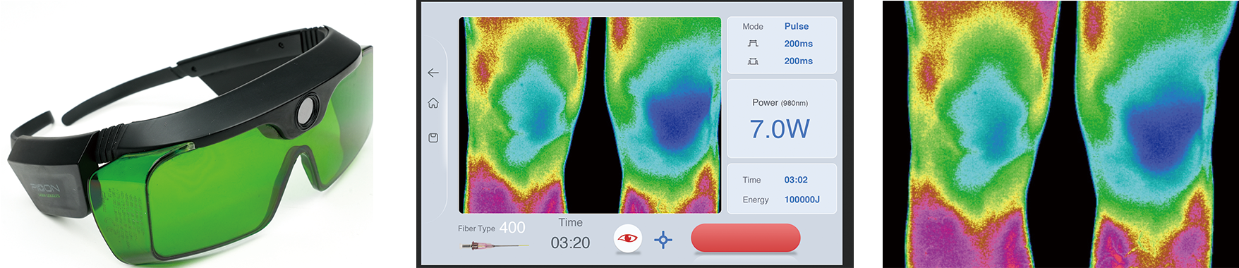 Thermal Imaging