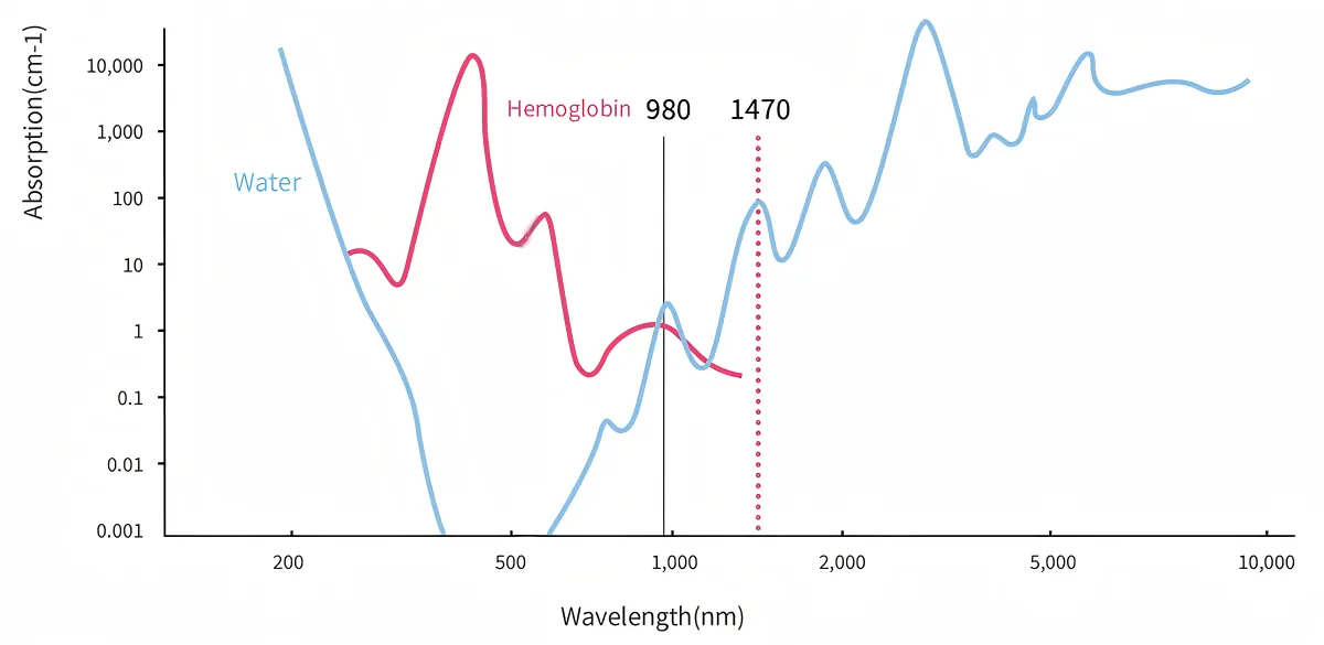 Absorption spectrum of water and hemoglobin plotted against wavelength, marking the 980 nm and 1470 nm diode laser wavelengths used in PLDD