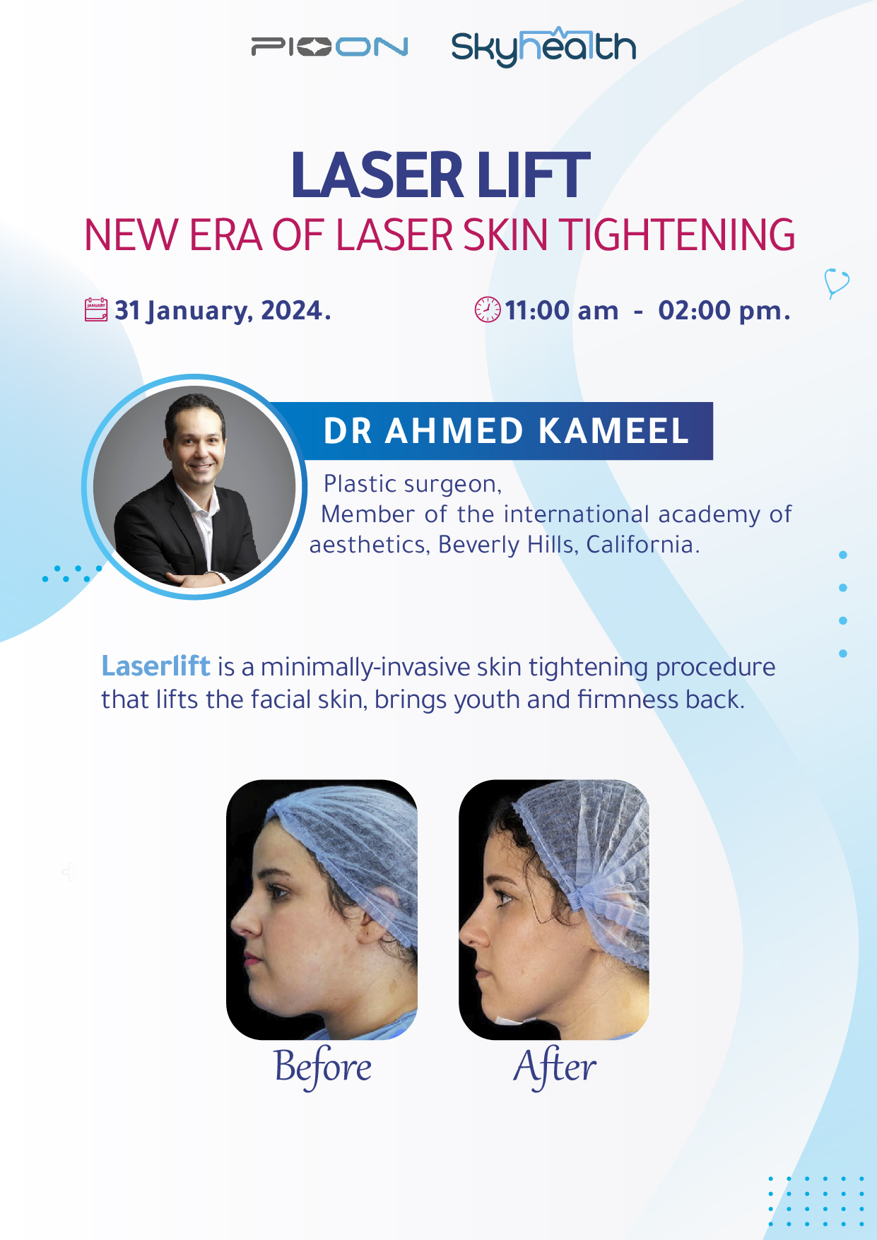 Laser Treatment