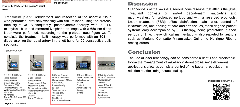 pioon dental laser