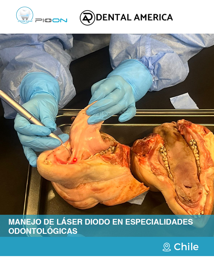 laser-dentistry-diode-laser-training-pioon-dental-education-chile-2.jpg