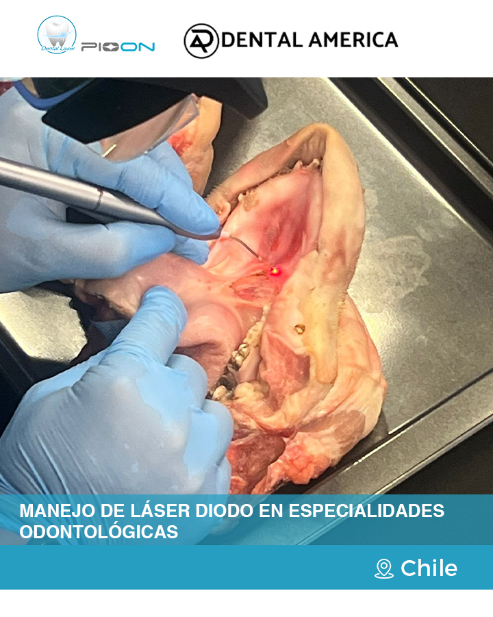 laser-dentistry-diode-laser-training-pioon-dental-education-chile-3.jpg