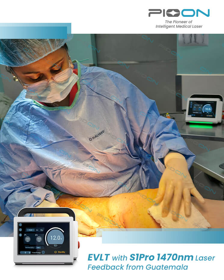 Vascular Surgery laser vein treatment 1470nm wavelength
