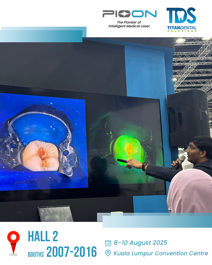 PIOON MIDEC 2025 Titan Dental UTU Laser Dental Laser