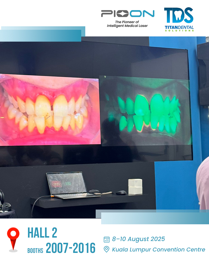 UTU 4-Wavelength Laser