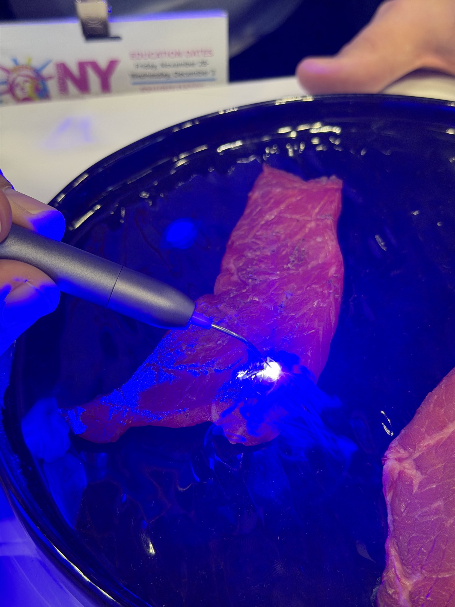 PIOON Dental Laser Demos & Clinical Insights