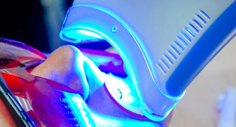 led-clinical-teeth-whitening.png led-clinical-teeth-whitening.png