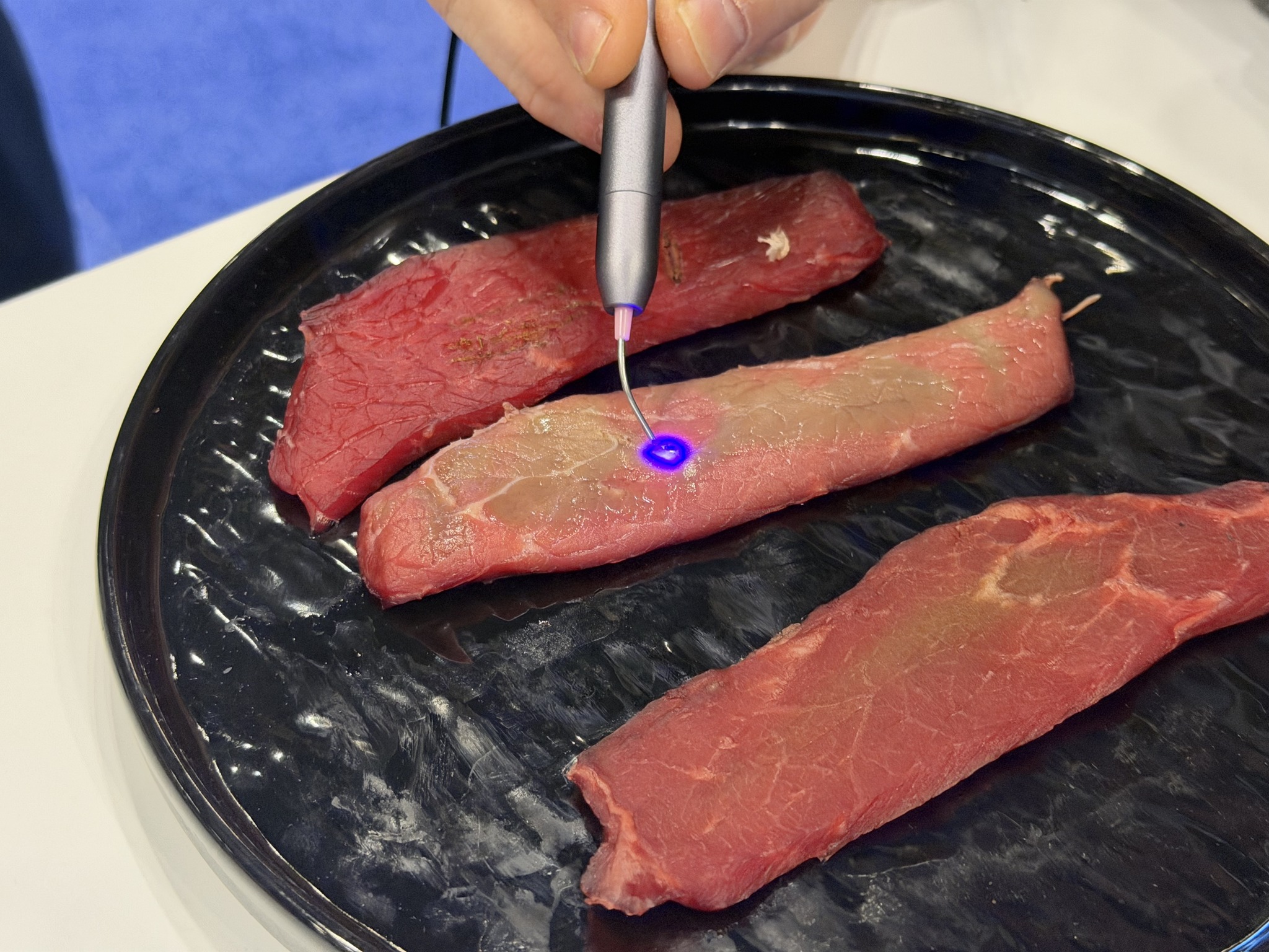 How Laser Dentistry Boosts Efficiency & Patient Comfort