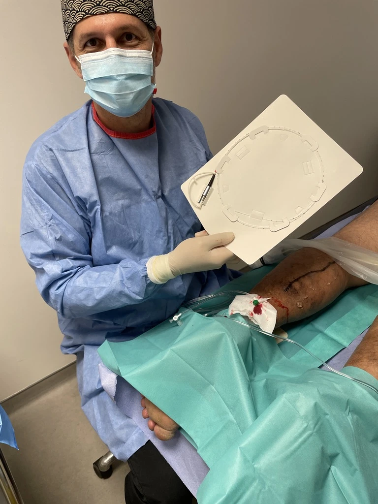 Clinical results of PIOON medical laser and 400 fiber optic