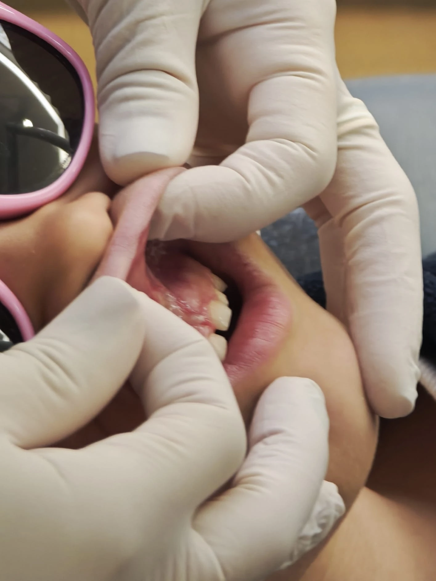 New-Generation Dental Laser Technology