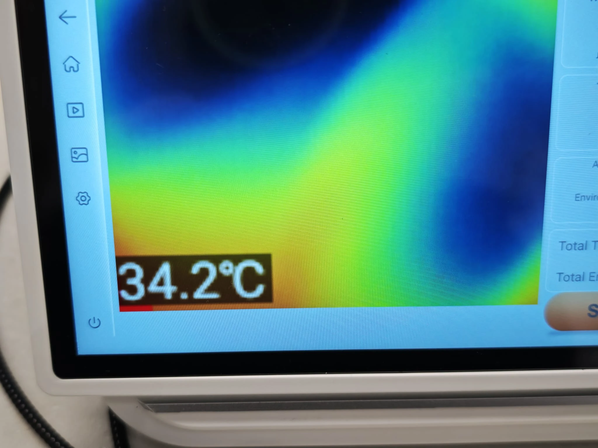 New-Generation Dental Laser Technology