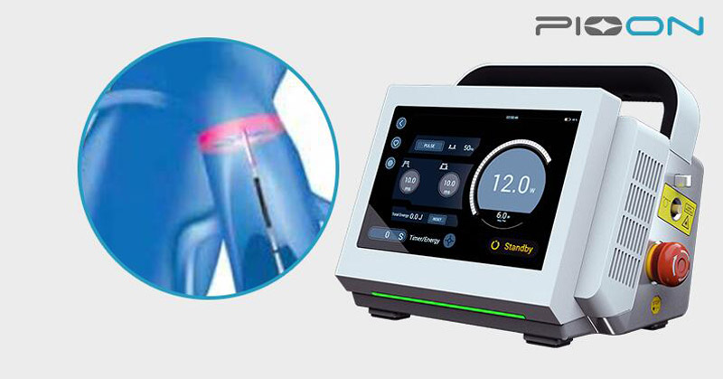 PIOON 1470 nm diode laser system for EVLA treatment with Radial fiber