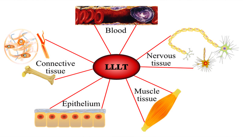 the effect of (LLLT)Low-level laser therapy