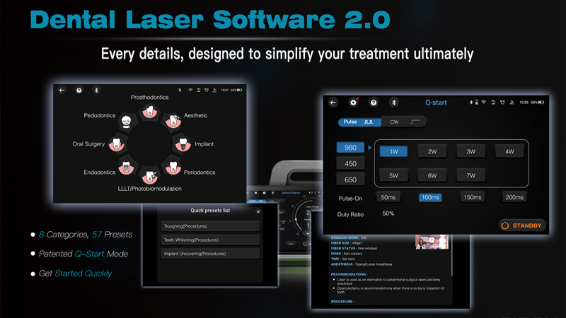 Dental Laser 2.0