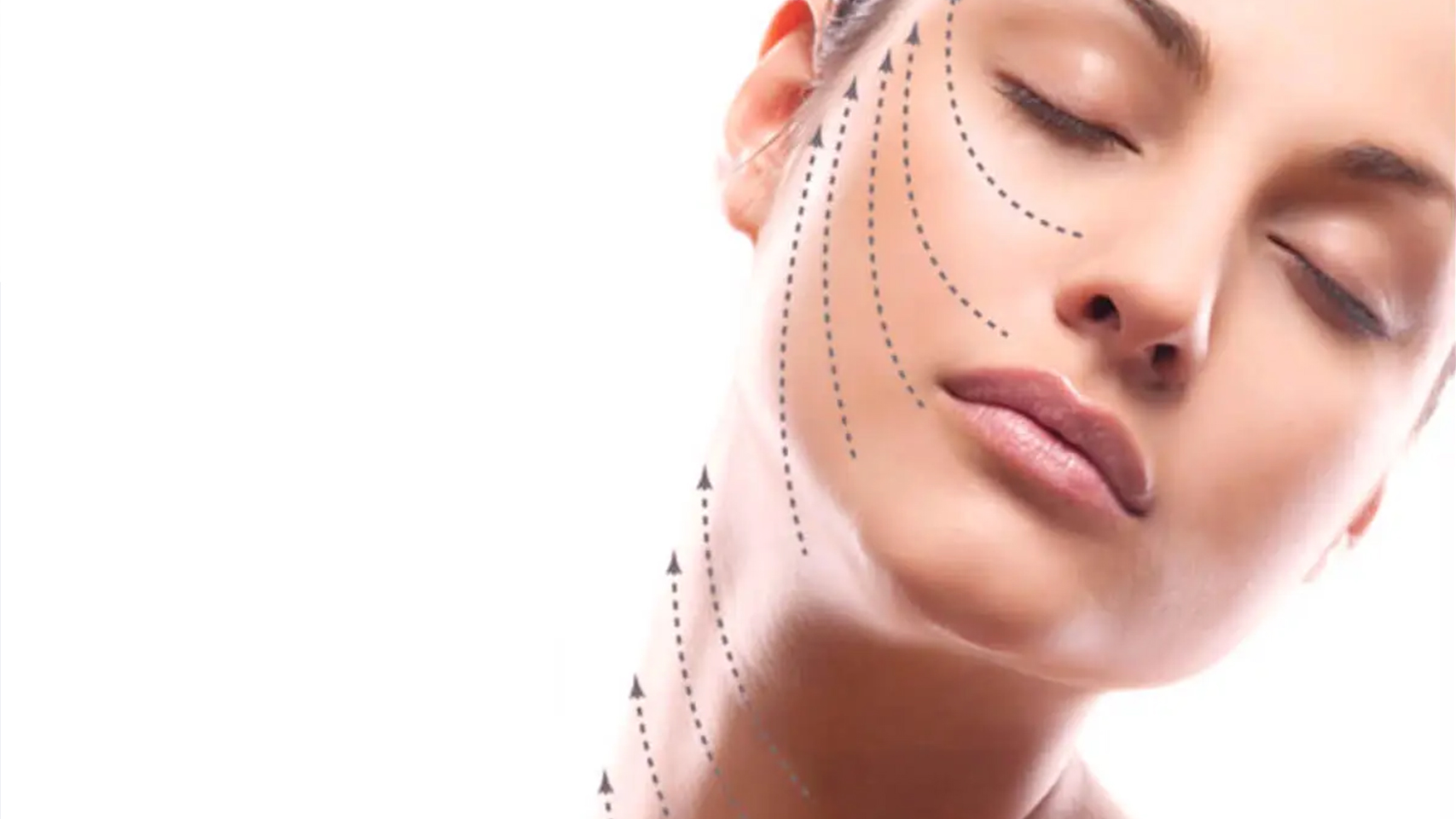 Facial Contouring with Laser——the Next Level of Non-invasive Laser Lift Procedure