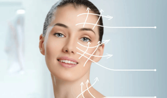 1470nm Laser-assisted Facial Lifting