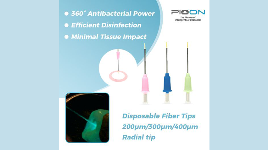 Radial Fiber Tips: Redefining Root Canal Treatment with 360° Precision!