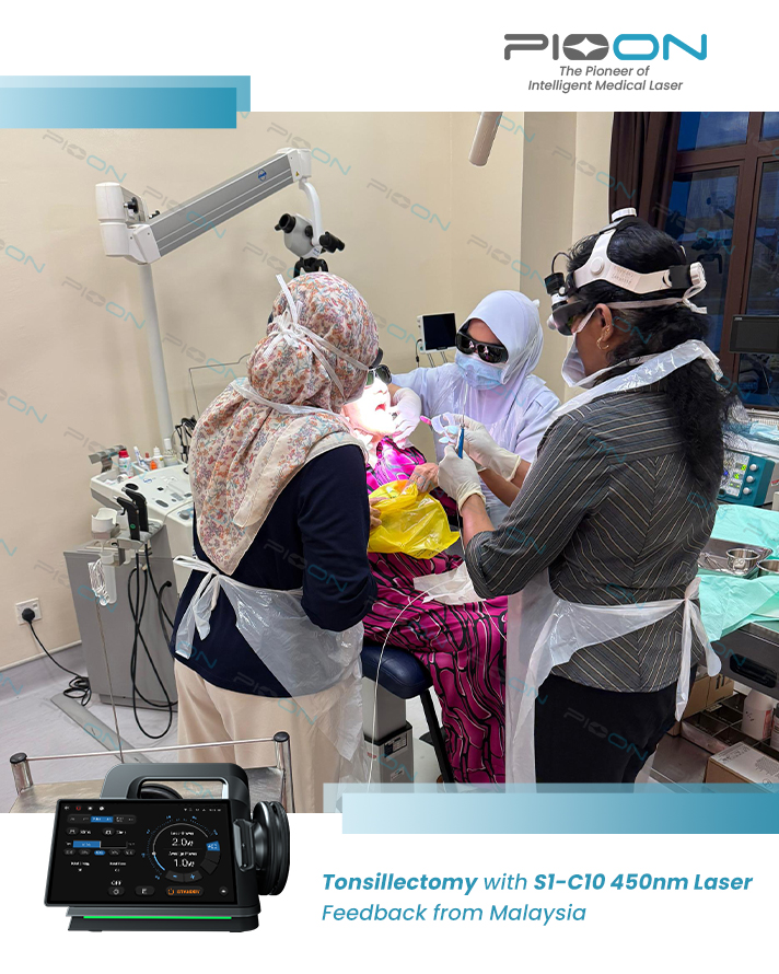 Bloodless Tonsillectomy with Blue Laser Technology