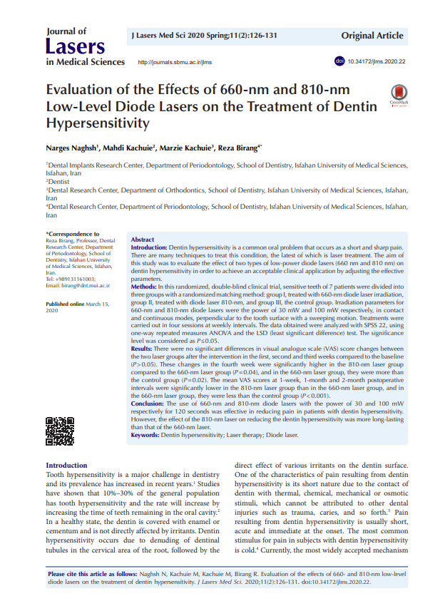 Effective Relief for Tooth Sensitivity with Dual-Wavelength Laser Therapy (660 nm & 810 nm)