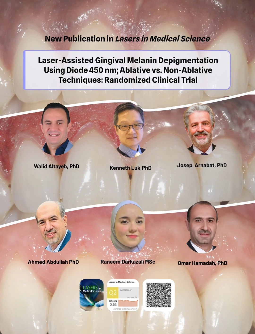S3 450 nm Blue Diode Laser Featured in Landmark Clinical Study on Gingival Depigmentation