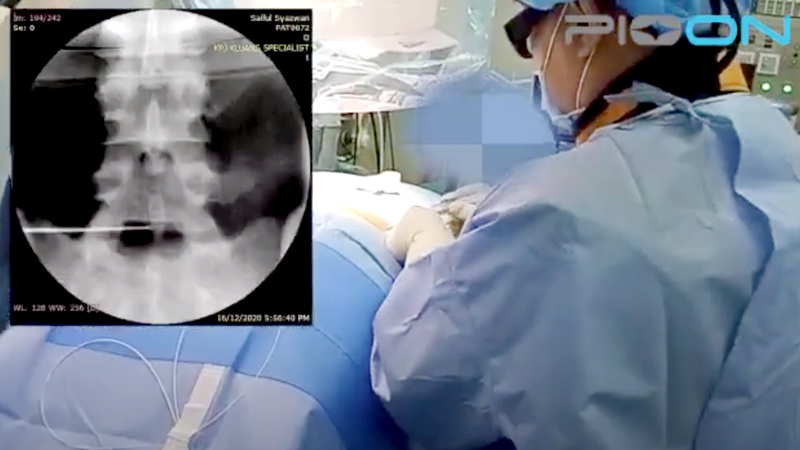 Orthopaedics (PLDD)