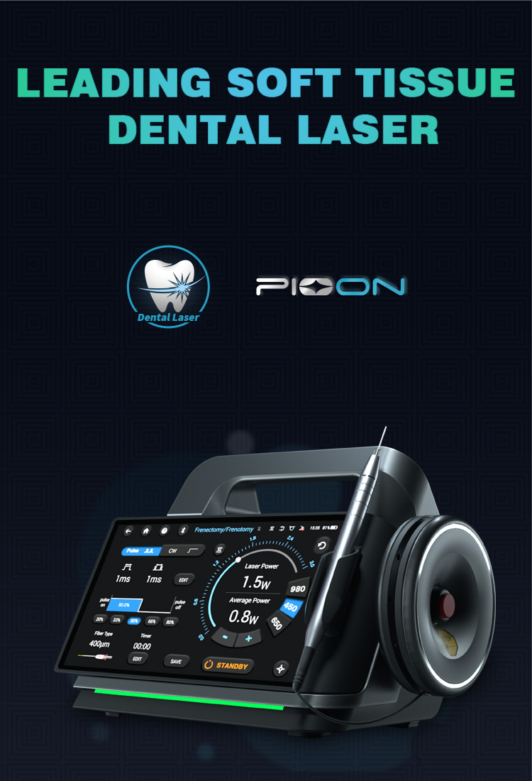 s3Dental diode laser,Soft tissue dental laser,Threewavelength dental